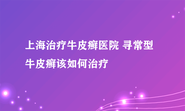 上海治疗牛皮癣医院 寻常型牛皮癣该如何治疗