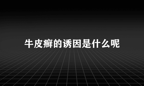 牛皮癣的诱因是什么呢