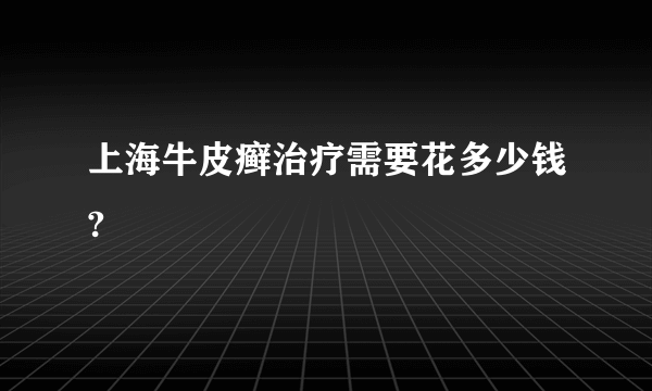 上海牛皮癣治疗需要花多少钱?