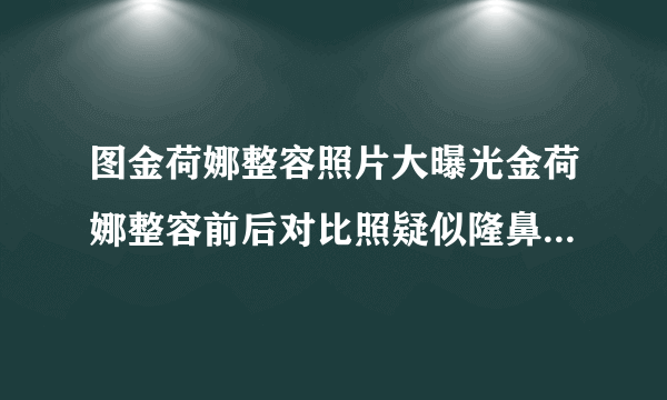 图金荷娜整容照片大曝光金荷娜整容前后对比照疑似隆鼻-飞外网