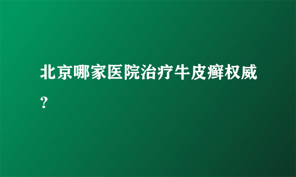 北京哪家医院治疗牛皮癣权威？