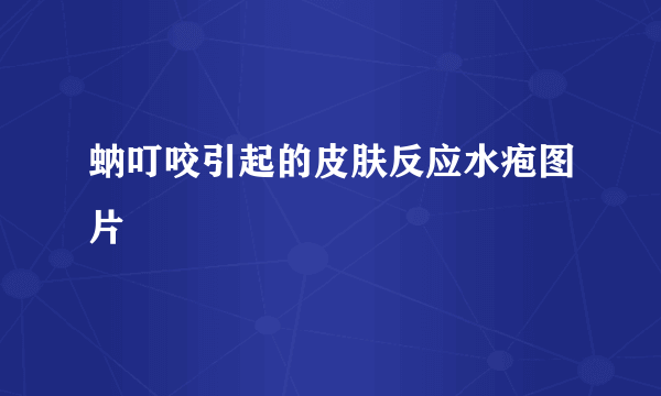 蚋叮咬引起的皮肤反应水疱图片