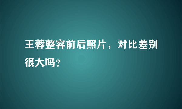 王蓉整容前后照片，对比差别很大吗？