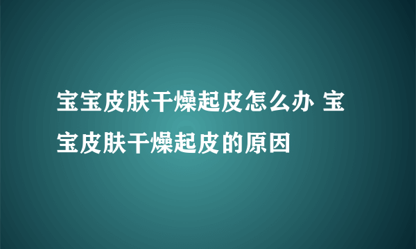 宝宝皮肤干燥起皮怎么办 宝宝皮肤干燥起皮的原因