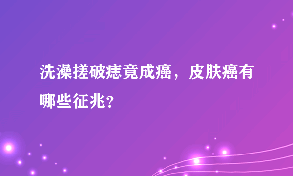 洗澡搓破痣竟成癌，皮肤癌有哪些征兆？