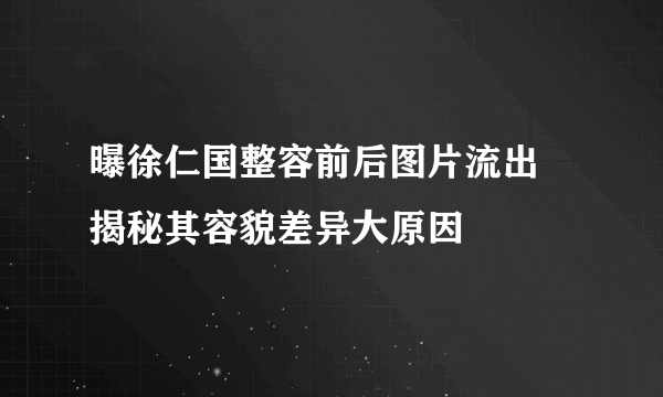 曝徐仁国整容前后图片流出    揭秘其容貌差异大原因