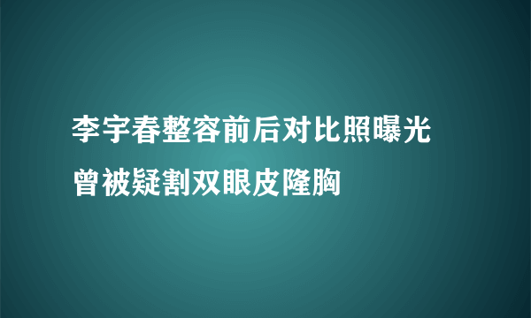 李宇春整容前后对比照曝光 曾被疑割双眼皮隆胸