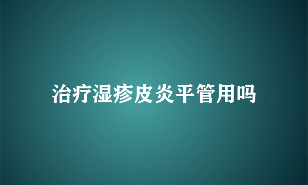 治疗湿疹皮炎平管用吗