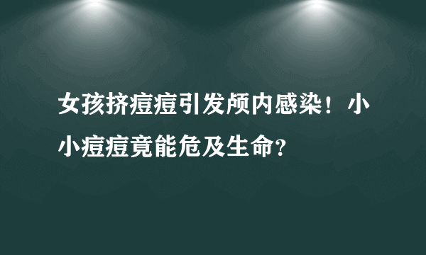 女孩挤痘痘引发颅内感染！小小痘痘竟能危及生命？