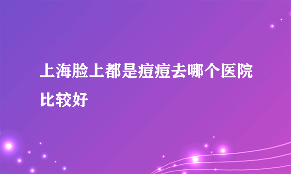 上海脸上都是痘痘去哪个医院比较好