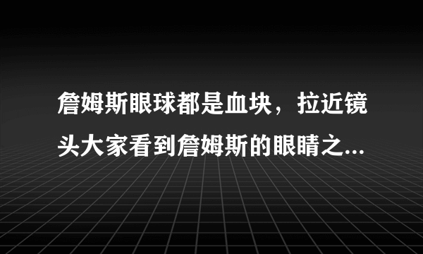 詹姆斯眼球都是血块，拉近镜头大家看到詹姆斯的眼睛之后，是什么感受？