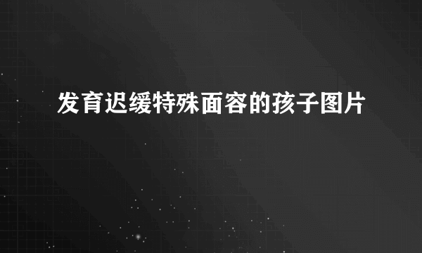 发育迟缓特殊面容的孩子图片