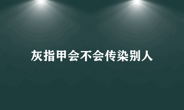 灰指甲会不会传染别人