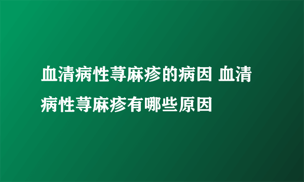 血清病性荨麻疹的病因 血清病性荨麻疹有哪些原因