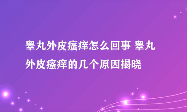 睾丸外皮瘙痒怎么回事 睾丸外皮瘙痒的几个原因揭晓