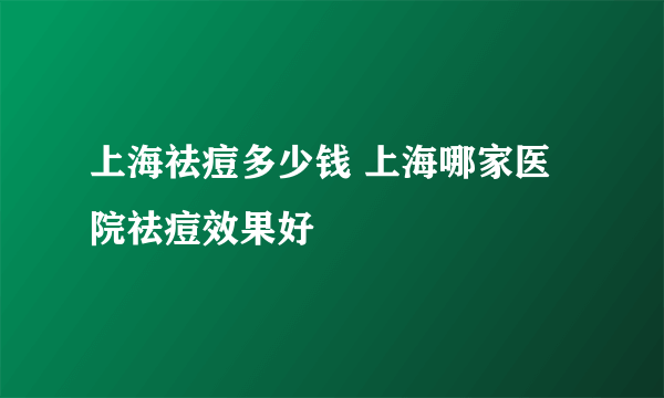 上海祛痘多少钱 上海哪家医院祛痘效果好