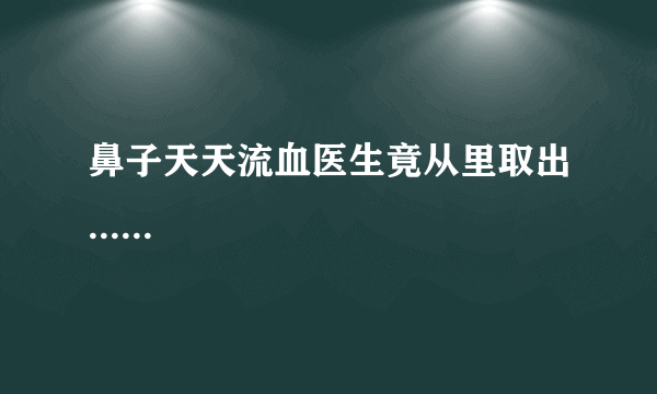 鼻子天天流血医生竟从里取出......