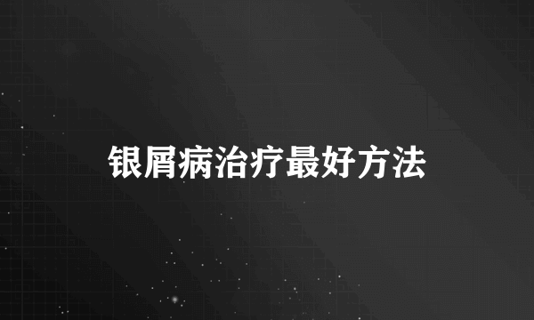 银屑病治疗最好方法