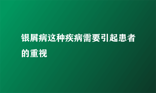 银屑病这种疾病需要引起患者的重视