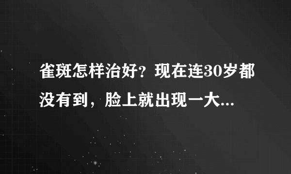 雀斑怎样治好？现在连30岁都没有到，脸上就出现一大片...