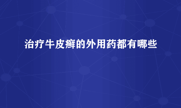 治疗牛皮癣的外用药都有哪些