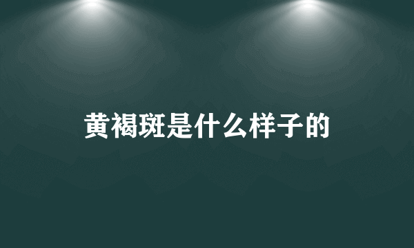 黄褐斑是什么样子的