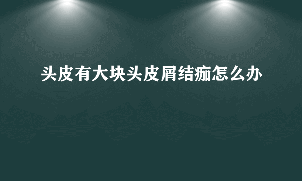 头皮有大块头皮屑结痂怎么办