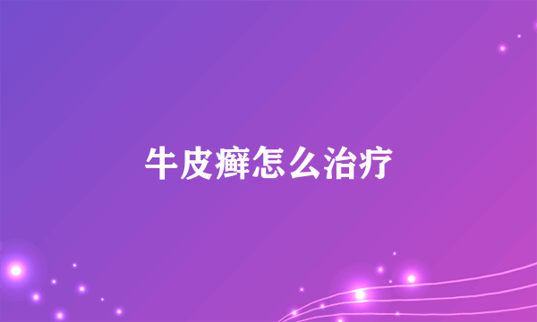 牛皮癣怎么治疗