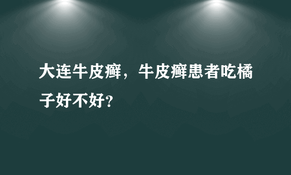 大连牛皮癣，牛皮癣患者吃橘子好不好？