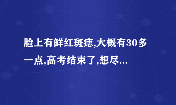 脸上有鲜红斑痣,大概有30多一点,高考结束了,想尽快去掉...