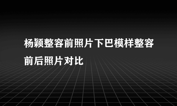 杨颖整容前照片下巴模样整容前后照片对比