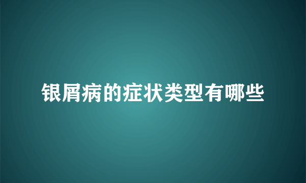 银屑病的症状类型有哪些