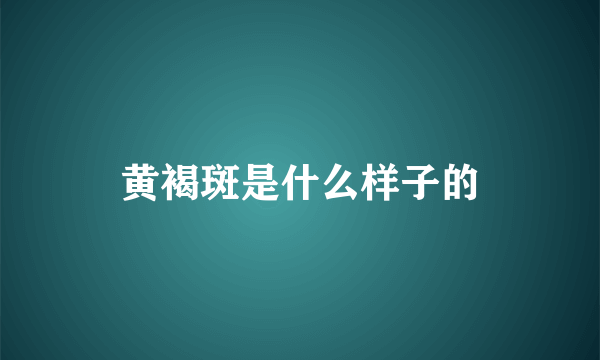 黄褐斑是什么样子的