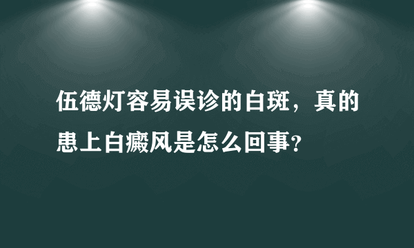 伍德灯容易误诊的白斑，真的患上白癜风是怎么回事？