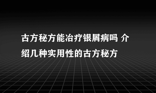 古方秘方能冶疗银屑病吗 介绍几种实用性的古方秘方