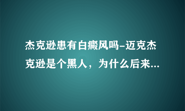 杰克逊患有白癜风吗-迈克杰克逊是个黑人，为什么后来他居然那么白？