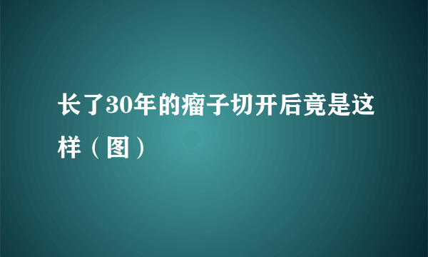 长了30年的瘤子切开后竟是这样（图）