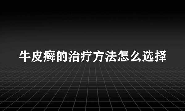 牛皮癣的治疗方法怎么选择