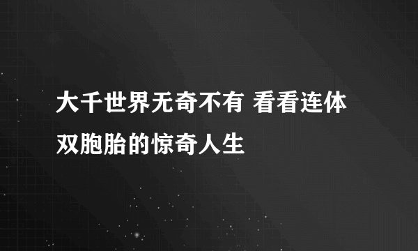 大千世界无奇不有 看看连体双胞胎的惊奇人生