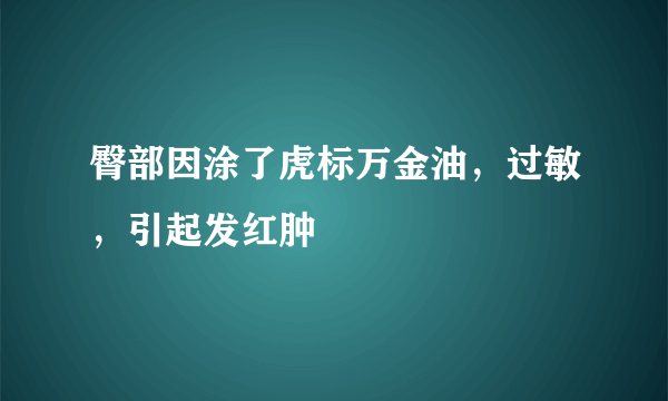 臀部因涂了虎标万金油，过敏，引起发红肿