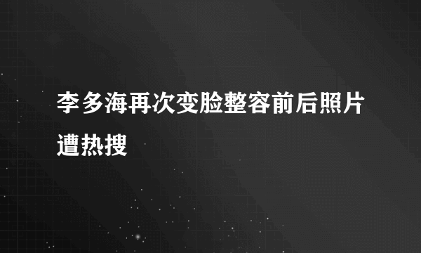 李多海再次变脸整容前后照片遭热搜