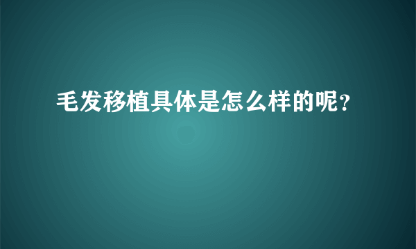 毛发移植具体是怎么样的呢？