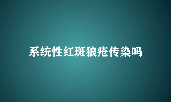 系统性红斑狼疮传染吗