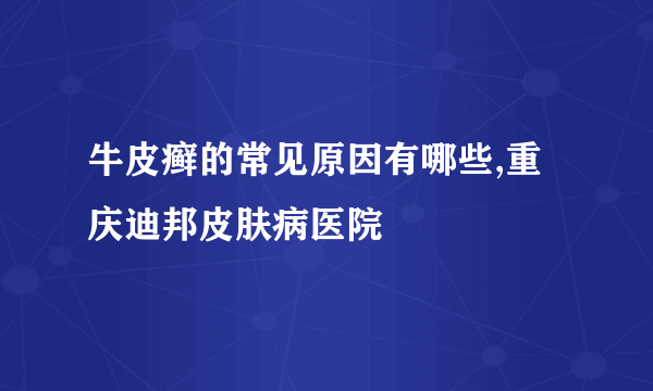 牛皮癣的常见原因有哪些,重庆迪邦皮肤病医院