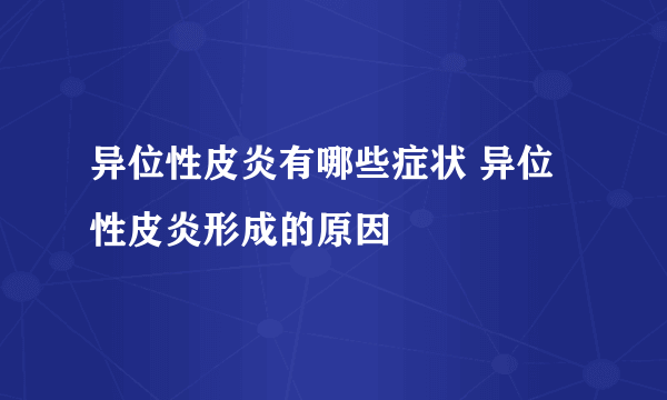 异位性皮炎有哪些症状 异位性皮炎形成的原因