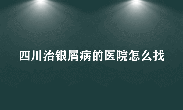 四川治银屑病的医院怎么找