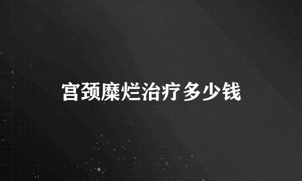 宫颈糜烂治疗多少钱