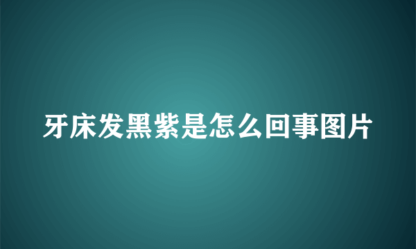 牙床发黑紫是怎么回事图片