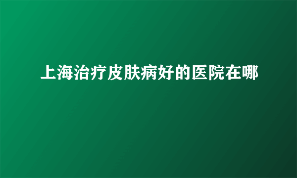 上海治疗皮肤病好的医院在哪