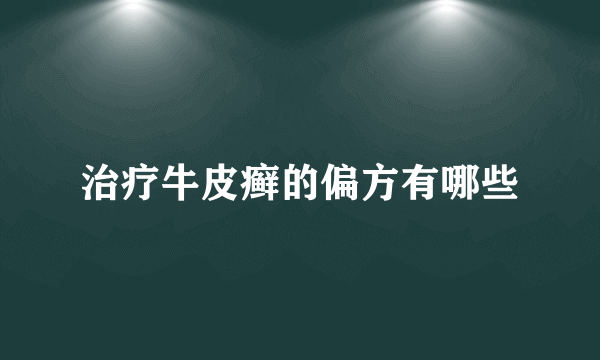 治疗牛皮癣的偏方有哪些